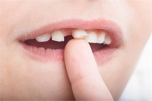 Should I pull out my child’s wobbly tooth?