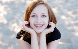 5 Ways to Take Care of Braces during Orthodontic Treatment