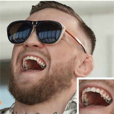 When you are a millionaire but still stuck with those amalgam fillings