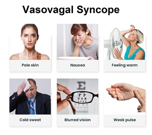 What is Vasovagal syncope?