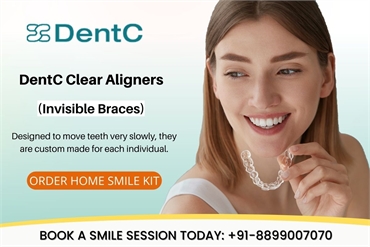 Best Clear Invisible Aligners