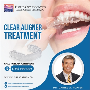 Clear Aligner Treatment