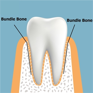 What is bundle bone?