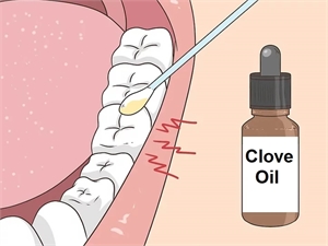 Applying clove oil to teeth with the help of a cotton bud