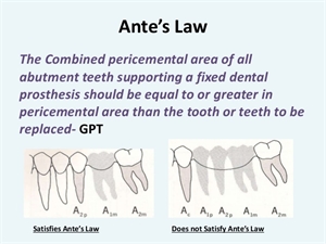 Antes law in restorative dentistry