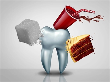 Tooth Decay Prevention for College Students - A Must-Read Guide by Phil Collins from EssayService 