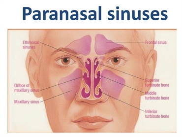 What are paranasal sinuses?