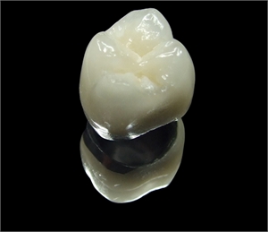 What is a PFM dental crown?