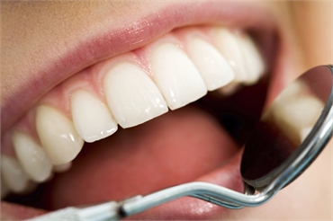  5 Reasons Why You Need To Get Regular Dental Check-Ups