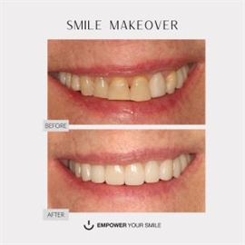 Empower Your Smile DDS