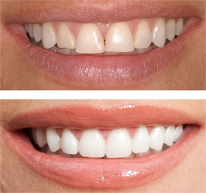 Cosmetic Dentistry Can Keep Your Smile Alive and Healthy 