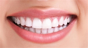 6 Worst Teeth-Whitening Methods You Should Avoid 