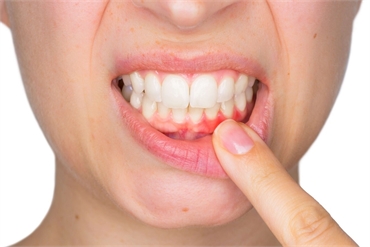 10 Foods That Promote Good Gum Health