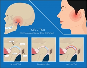 What is TMJ Arthroscopy procedure?