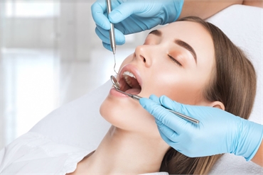 How Long Do Dental Fillings Last And When Do You Need Replacement?