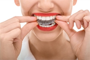 Invisalign Can Help You Achieve Faster Results and Improve Your Oral Hygiene