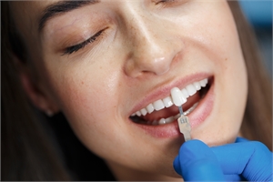 How Can Composite Bonding Enhance Your Smile