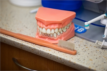 Dental model at Clearwater Dental Associates