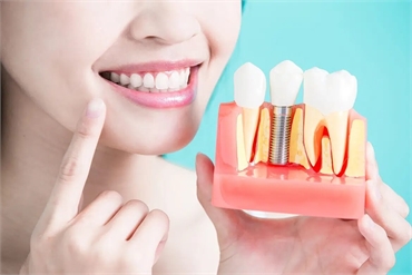 Why Dental Implants May Be Ideal For You