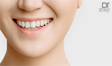 Reasons Why Porcelain Veneers Are the Best Option