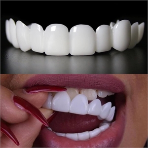 Snap on Smile is a system for removable clip on dental veneers