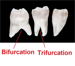 What is bifurcation and trifurcation in a tooth?