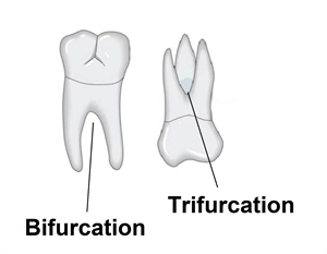 What is the difference between tooth bifurcation and tooth trifurcation