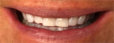 Dentistry of Poulsbo