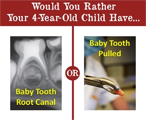 Why have a root canal treatment on a baby tooth and not extract the tooth?