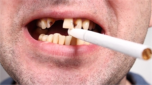 What Are the Long-Term Effects of Tobacco Products on Your Dental Health?
