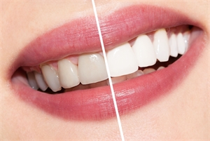 9 Little Known Tips For Healthy Teeth And Gums