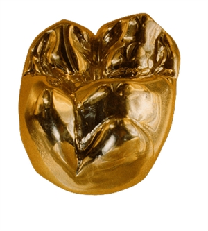 Full Cast Gold Crown