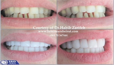 Vneeers in Beirut Lebanon with Dr Habib Zarifeh head of CMC Dental Department