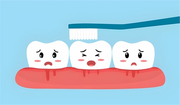 Don't Let Bleeding Gums Ruin Your Smile Tips for Prevention