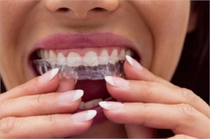 House of Dontics | Dr. Chaitali Parikh | Invisalign Clear Aligners | Braces | Dental Implant Center | Orthodontic Treatment