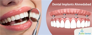 What is the reason to look into Dental Implant Treatment