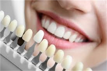 Different types and Benefits of Dental Impants in Ahmedabad