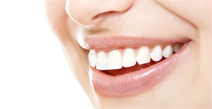 best implant clinic in Ahmedabad