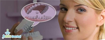 Take your Smile back with excellent Cosmetic Dentistry in Ahmedabad