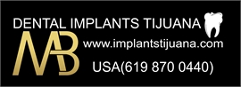 MAB Dental Implants Tijuana
