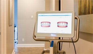 iTero scanner at Wrightsville Dental Wilmington NC