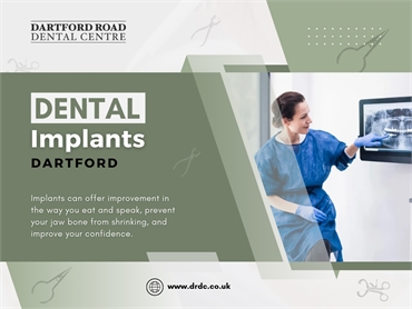 Dartford Dental Implants