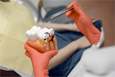 7 Stages of Root Canal Treatment