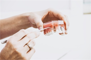 Why should you choose dental implants