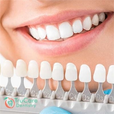 Cosmetic Dentistry in Roswell Georgia
