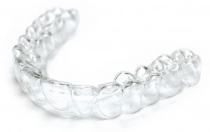 Clear Dental Retainers