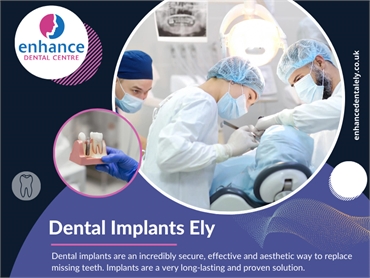 Dental Implants Ely