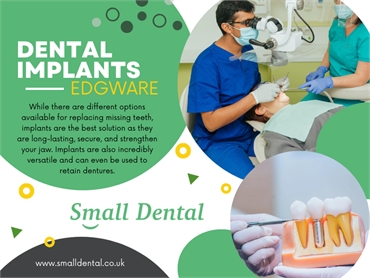 Dental Implants in Edgware