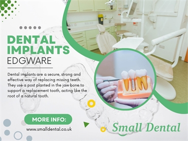 Dental Implants Edgware
