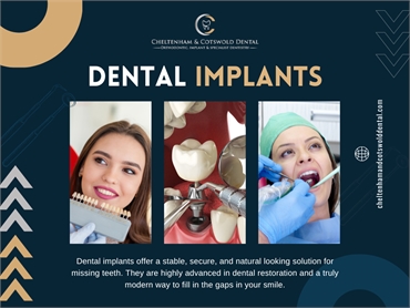 Dental Implants Cheltenham